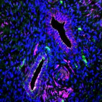 Hapangama Research Group (@hapangama_lab) 's Twitter Profile Photo Hapangama Research Group (@hapangama_lab) 's Twitter Profile Photo