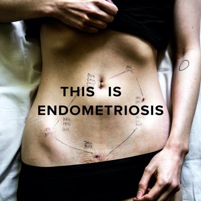 #thisisendometriosis 
REPRESENTATION  •  VALIDATION  •  EDUCATION
A global campaign by Georgie Wileman
JOIN THE MOVEMENT - WEBSITE COMING SOON