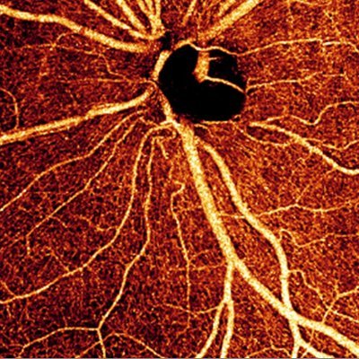 IOCS_Eye's profile picture. International Ocular Circulation Society
