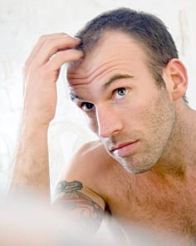 SeriousHairLoss's profile picture. Common hair loss treatment does exist. If you are experiencing some type of hair loss, then before you find the treatment that will work for you.