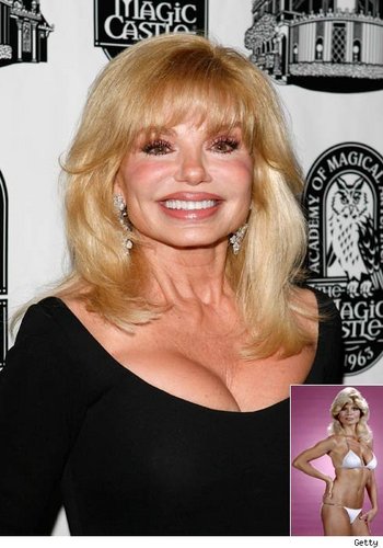 Loni Anderson