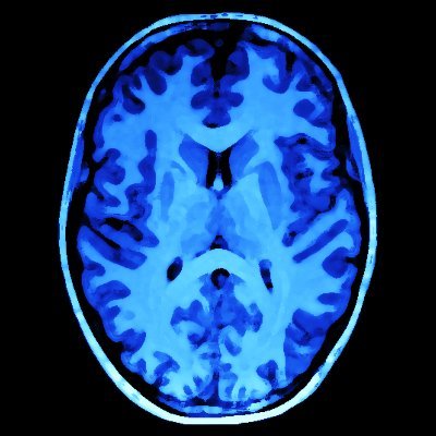 Post Doctoral Research Fellow, University of Edinburgh
Researching neuroimaging biomarkers in multiple sclerosis