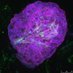 3D Cancer Models Group (@3dcancergroup) Twitter profile photo 3D Cancer Models Group (@3dcancergroup) Twitter profile photo