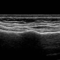 BUCKLED Research (@buckled_rct) 's Twitter Profile