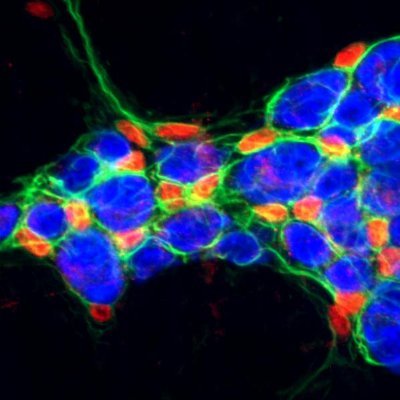Bornstein Lab. Investigating the function of the 'little brain' in the gut!
@UniMelbMDHS