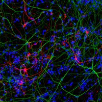Tornero's Lab (@nsc_braindamage) 's Twitter Profile Photo Tornero's Lab (@nsc_braindamage) 's Twitter Profile Photo