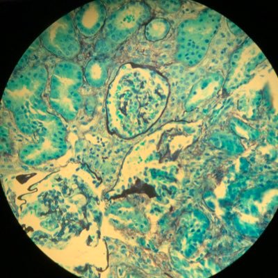 KidneySos's profile image