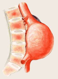 DrachtenVaat's profile picture. Vaatchirurgie Drachten, Nij Smellinghe.