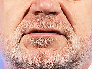 suralan's profile picture. 