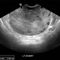 Creighton Ob/Gyn Fellowship in Women's Imaging (@wifellowshipphx) 's Twitter Profile