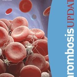 Thrombosis Update Profile