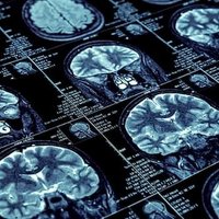 University of Colorado Neurology Residency Program (@ucoloradoneuro) 's Twitter Profile