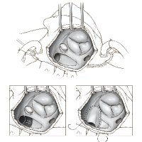 UC Davis CT Surgery Residency (@ucsurgery) 's Twitter Profile