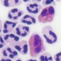 eosinophils Profile Picture