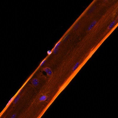 A virtual discussion group on skeletal/smooth/cardiac muscle funded by @MbD_UofT, @UofT, organized by @RokMatthew, @RaileanuVanessa, and @xu_bellaxixi