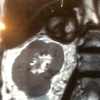 Urologic Oncology Updates(@UroOncologyOk) 's Twitter Profile Photo