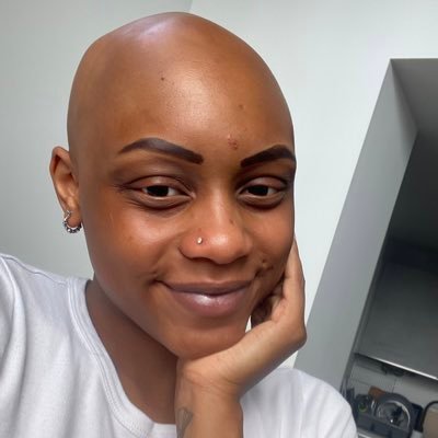 Poet, Practitioner and Theatre maker /Alopecia UK volunteer / Instagram -Shadaybbarts