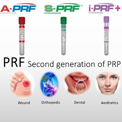 Platelet rich fibrin(PRF)can be considered as an autologous biomaterial which consists of leukocytes,platelet,and range of healing proteins within dense fibrin