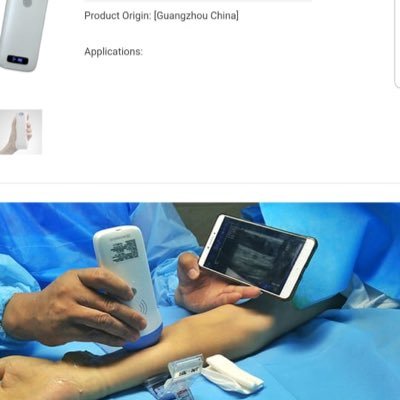 The de facto leader in ultrasound systems.  Handheld, wireless, iOS & Android.  Image quality that stands up to the best.