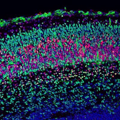 Investigación y acciones de los cannabinoides en el sistema nervioso. Red Iberoamericana de Investigacion CANNALATAN