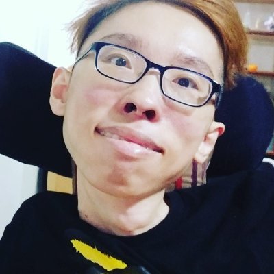 Duchenne Muscular Dystrophy Patient
Email:Edwin@servehope.com
Physically Disadvantage, Employed in ServeHope
A social Enterprise found by Grace Wong
