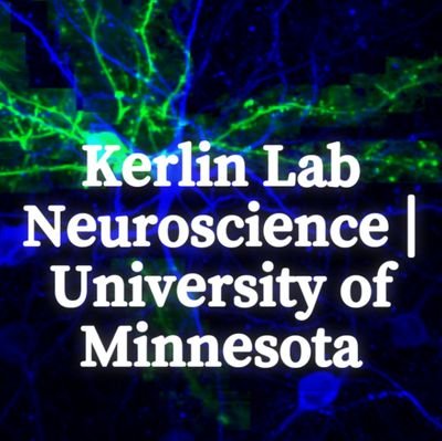 Aaron Kerlin Lab | University of Minnesota - Twin Cities | Optical Imaging and Brain Science Medical Discovery Team