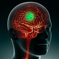 Brainchemistry3 Profile Picture