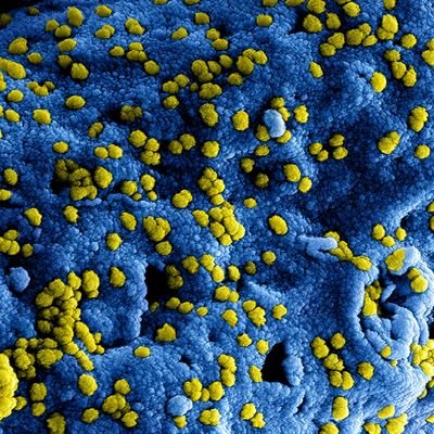 Dagelijks updates met betrekking tot de ontwikkelingen omtrent het coronavirus.