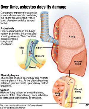 Informative videos and articles on Mesothelioma, Asbestos, Mesothelioma, Mesothelioma Symptoms, Mesothelioma Treatment and more