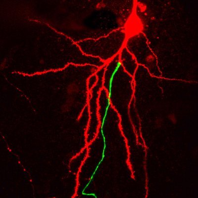bothlab's profile picture. We study information flow in morphologically different hippocampal pyramidal neurons during learning and memory. Follow our science, social activities and more.