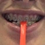 bracesnipat's profile picture. anong color kaya aq next???