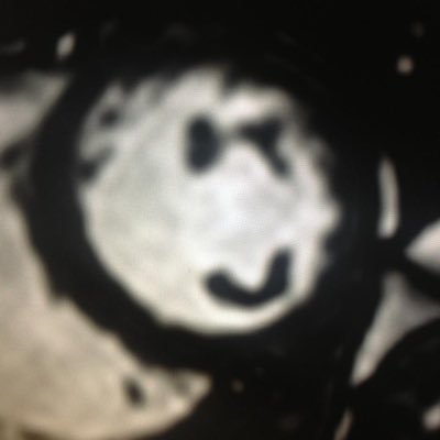 Dr. Anthon Fuisz, MD Profile