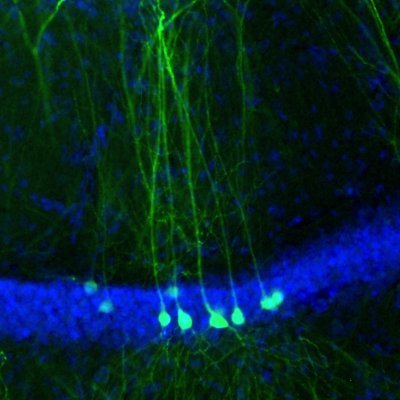 neurons_networks_oscillations
Medical Faculty Heidelberg @uniklinik_hd