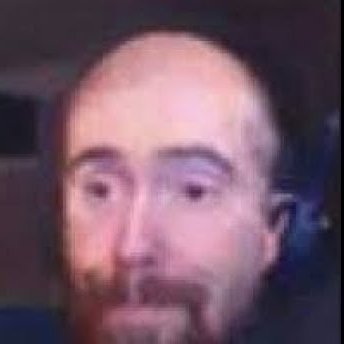 Asmongold has lots of hair!