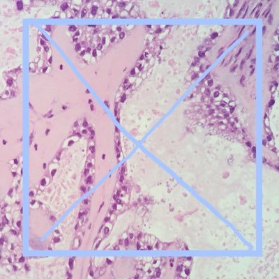 Pathologist in Japan
Interested in head and neck, gynecology, etc.