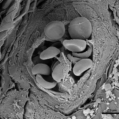 Human blood histology with clinical correlations