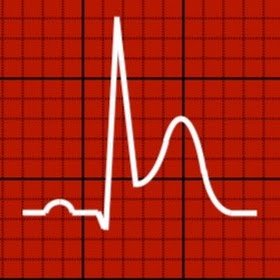 12-Lead ECG Interpretation, Resuscitation, Time Sensitive Diagnoses.