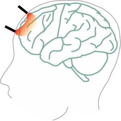 Translational Optics Imaging and Spectroscopy (TROPICS) Lab at USF. Diffuse Correlation Spectroscopy, laser speckle, and Biophotonics for imaging blood flow