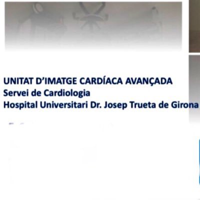 Divulgació científica i difusió en imatge cardíaca avançada #Echofirst #ecocardiography #CardiacCT #CardiacMR #stresstest