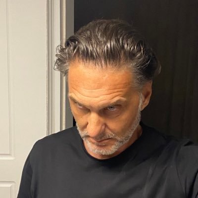 UszDidi's profile picture. Keep it simple Thoracic Surgeon working @Unispital_Zurich Special interest Minimal-invasive Surgery Robotic Surgery Lung Volume Reduction Surgery