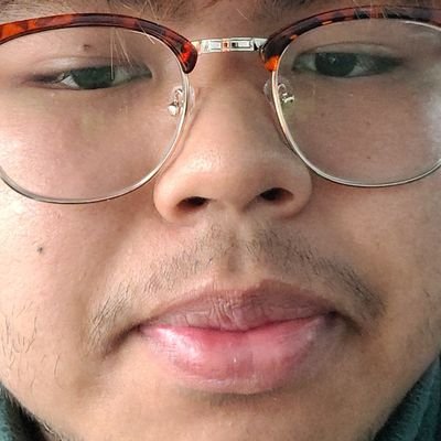Average Dude 🤢