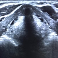 SLT Ultrasound(@SltUltrasound) 's Twitter Profile Photo