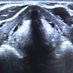 SLT Ultrasound (@sltultrasound) Twitter profile photo SLT Ultrasound (@sltultrasound) Twitter profile photo