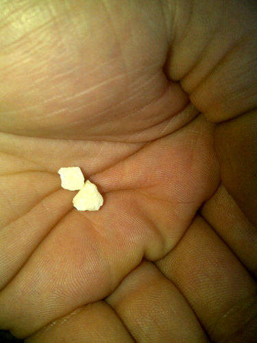 OliverThomas1's profile picture. I live in Toronto. I have issues with women, drugs, depression and alcohol. And I have issues with women. And women.