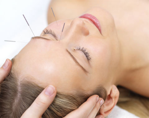 Atenue sus lineas de expresion mediante el tratamiento acupuntural facial de la medicina china. Interesados escribir a acupunturalifting@gmail.com