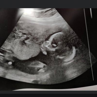 sillyca's profile picture. Should we live in fear?  Nah, that’s not living!