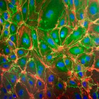 Tulane Trauma and Critical Care Research Lab (@tulanetccrlab) 's Twitter Profile