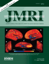 Journal of Magnetic Resonance in Medicine (JMRI) is an international journal is  devoted to the timely publication of basic and clinical MRI research.