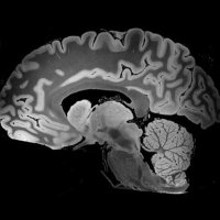 MGH Kong Lab (@labmgh) 's Twitter Profile Photo MGH Kong Lab (@labmgh) 's Twitter Profile Photo
