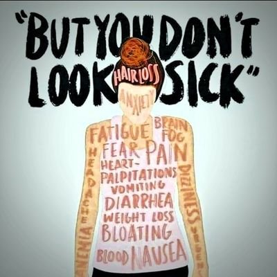 mbuzzmartian's profile picture. martian